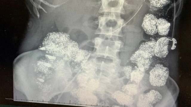 V&eacute;n M&agrave;n &Acirc;m Mưu T&agrave;n Độc: B&aacute;c Sĩ Đầu Độc Vợ V&igrave; Khoản Tiền Bảo Hiểm 26 Tỷ - Ảnh 2